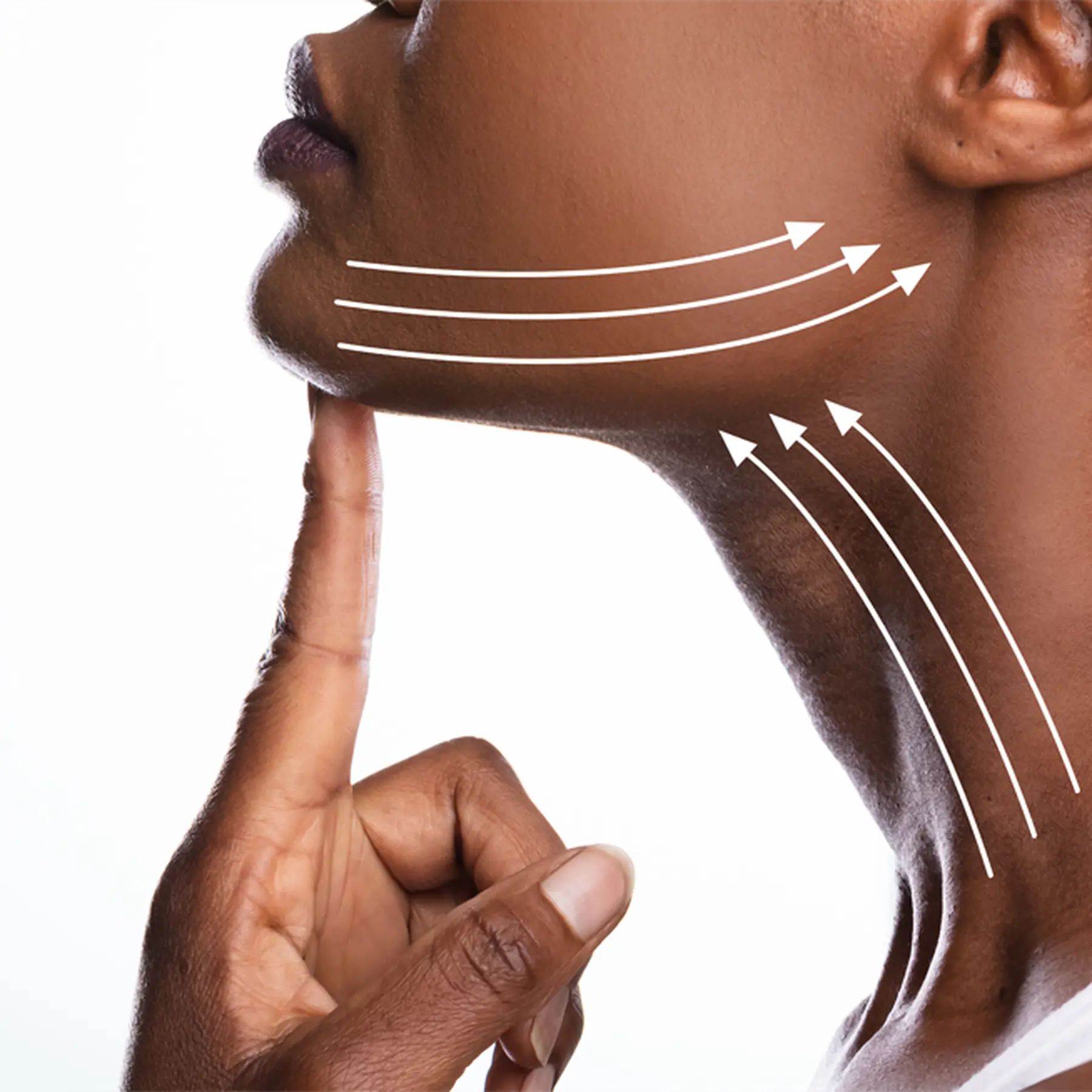 Lifting cervico-facial