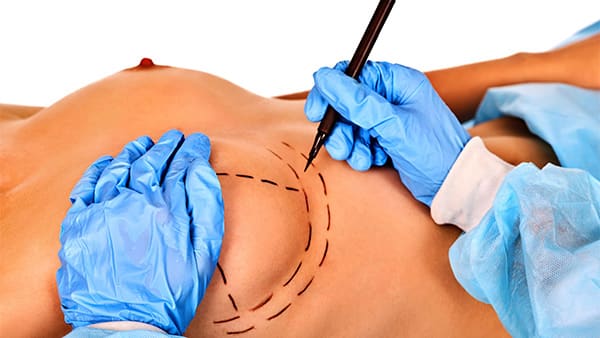 Asymétrie des seins