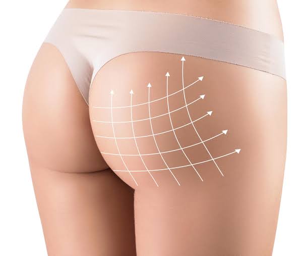 Lipofilling