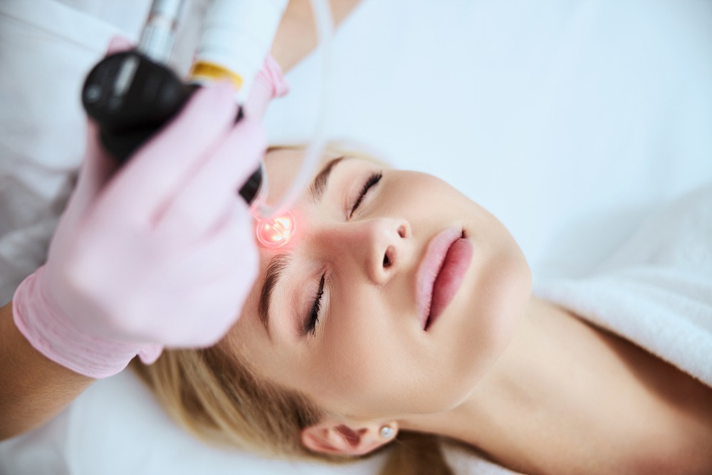 Rajeunissement du visage
